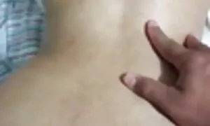 mu kumatako prolapse ...