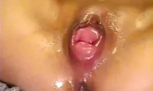 kuonongedwa ndi anth ...