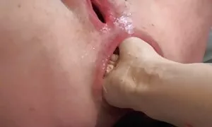 hule bulu wopweteka  ...